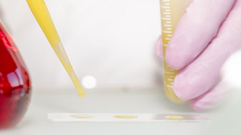 Patient Blood Management